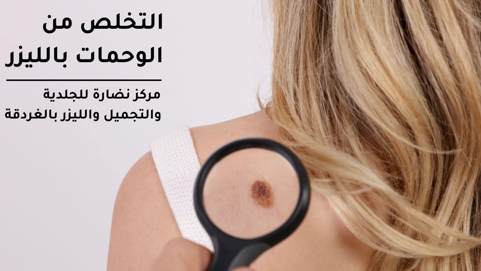 التخلص من الوحمات بالليزر